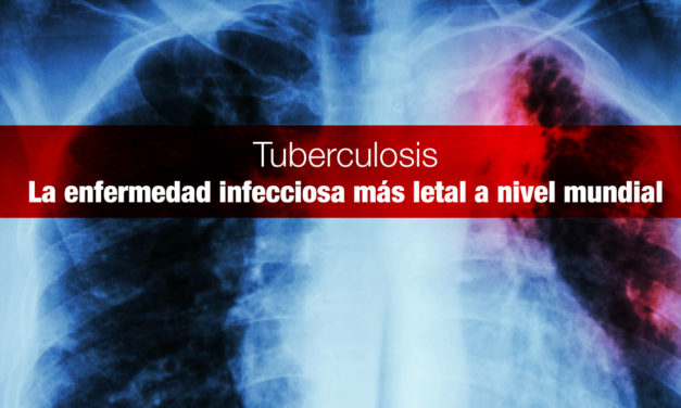 <strong>Tuberculosis,</strong> la enfermedad infecciosa más letal a nivel mundial