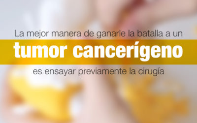 La mejor manera de ganarle la batalla a un tumor cancerígeno es ensayar previamente la cirugía
