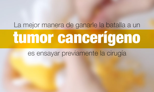 La mejor manera de ganarle la batalla a un tumor cancerígeno es ensayar previamente la cirugía