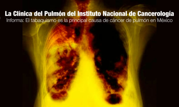 La Clínica del Pulmón del Instituto Nacional de Cancerología informa que el tabaquismo es la principal causa de cáncer de pulmón en México
