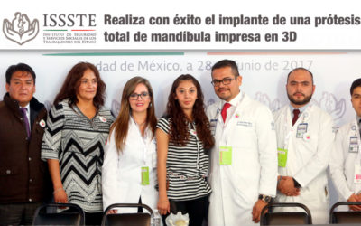 El ISSSTE se posiciona como la segunda institución médica a nivel mundial en realizar con éxito el implante de una prótesis total de mandíbula impresa en 3D