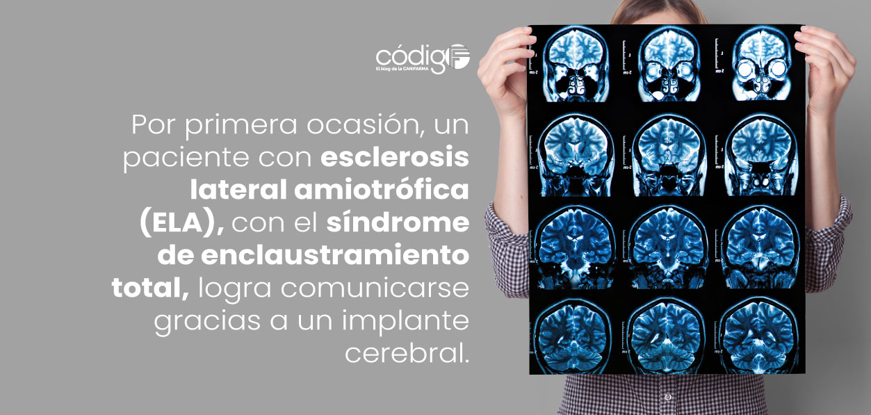 Por primera ocasión, un paciente con esclerosis lateral amiotrófica (ELA), con el síndrome de enclaustramiento total, logra comunicarse gracias a un implante cerebral.