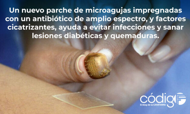 Un nuevo parche de microagujas impregnadas con un antibiótico de amplio espectro, y factores cicatrizantes, ayuda a evitar infecciones y sanar lesiones diabéticas y quemaduras.