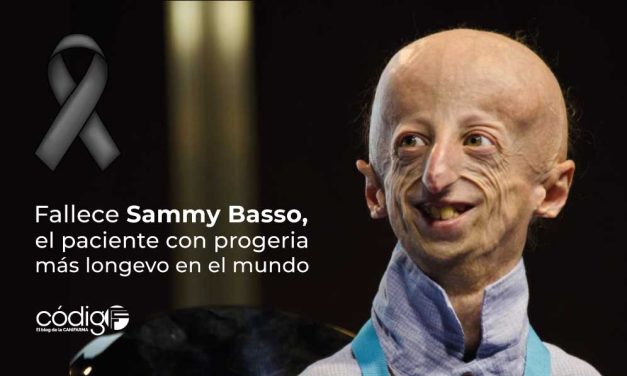 Fallece Sammy Basso, el paciente con progeria más longevo en el mundo