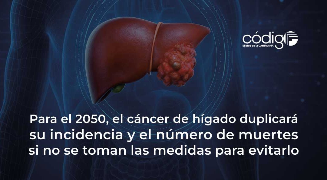 Para el 2050, el cáncer de hígado duplicará su incidencia y el número de muertes si no se toman las medidas para evitarlo