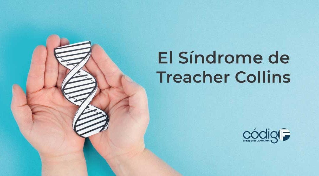 El Síndrome de Treacher Collins
