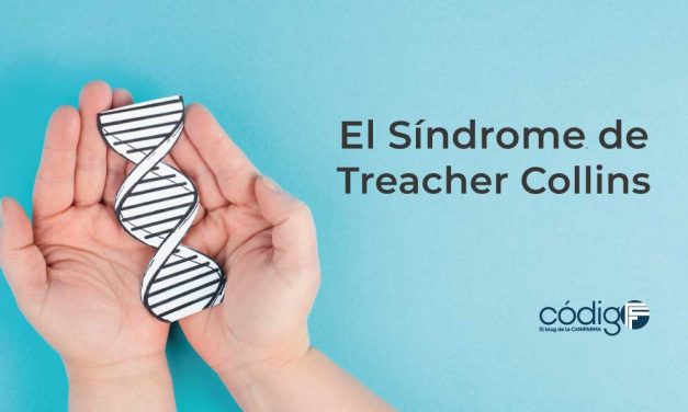 El Síndrome de Treacher Collins
