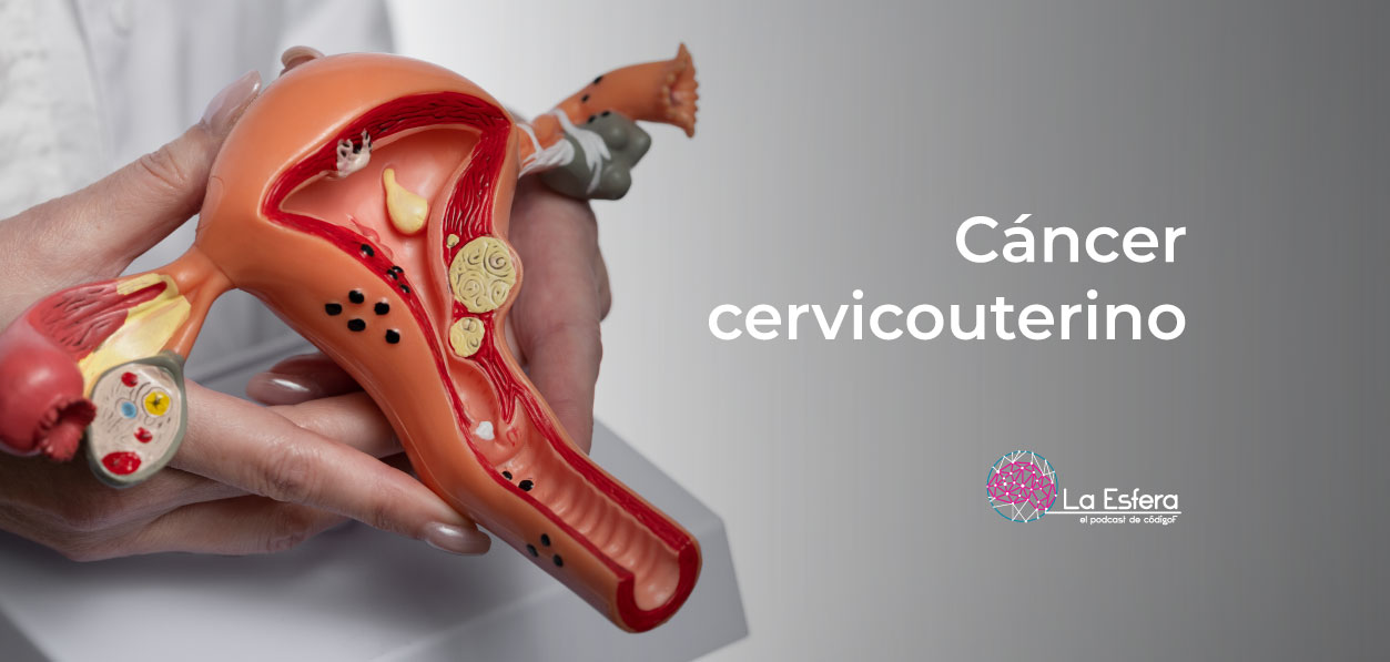 Cáncer cervicouterino | 11 de agosto de 2025 | Escúchelo ahora