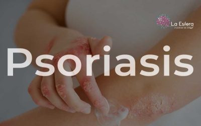 Psoriasis  | 27 de octubre de 2025 | Escúchelo ahora