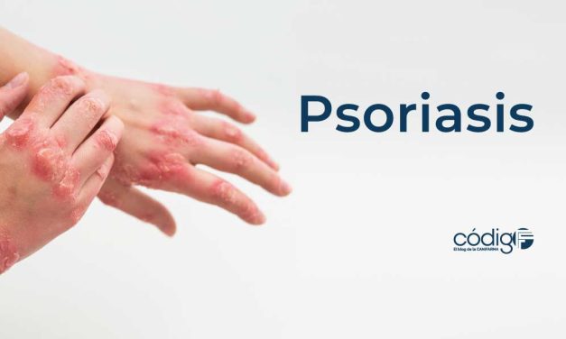 Psoriasis