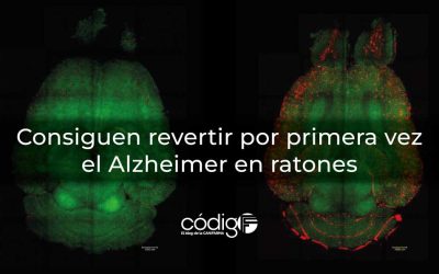 Consiguen revertir por primera vez el Alzheimer en ratones