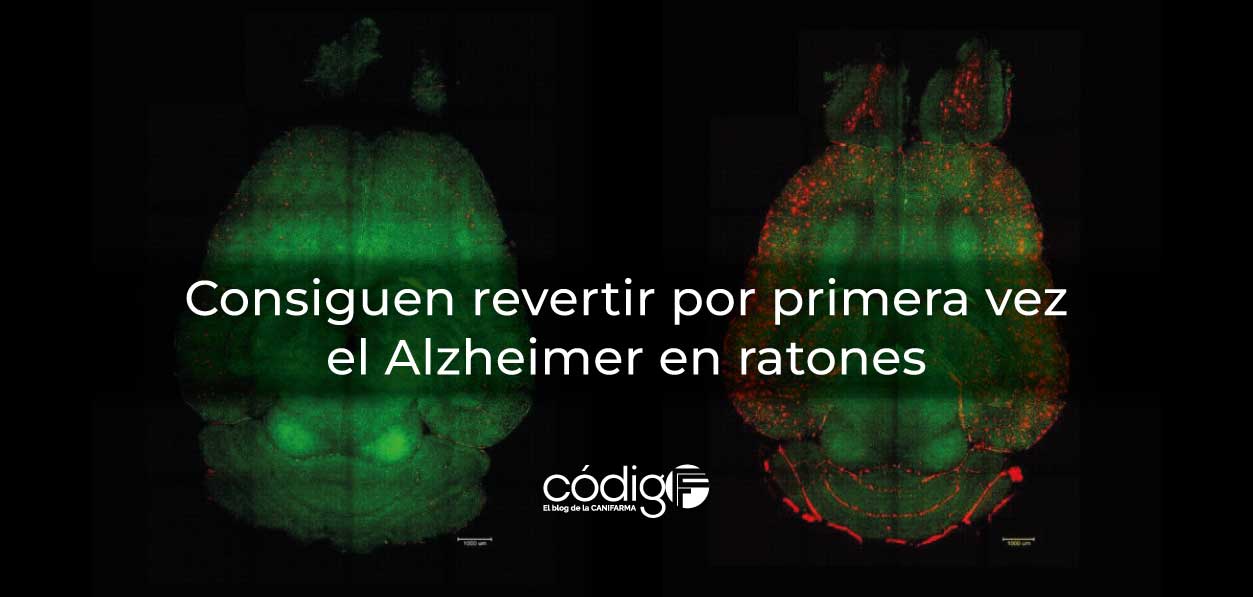 Consiguen revertir por primera vez el Alzheimer en ratones