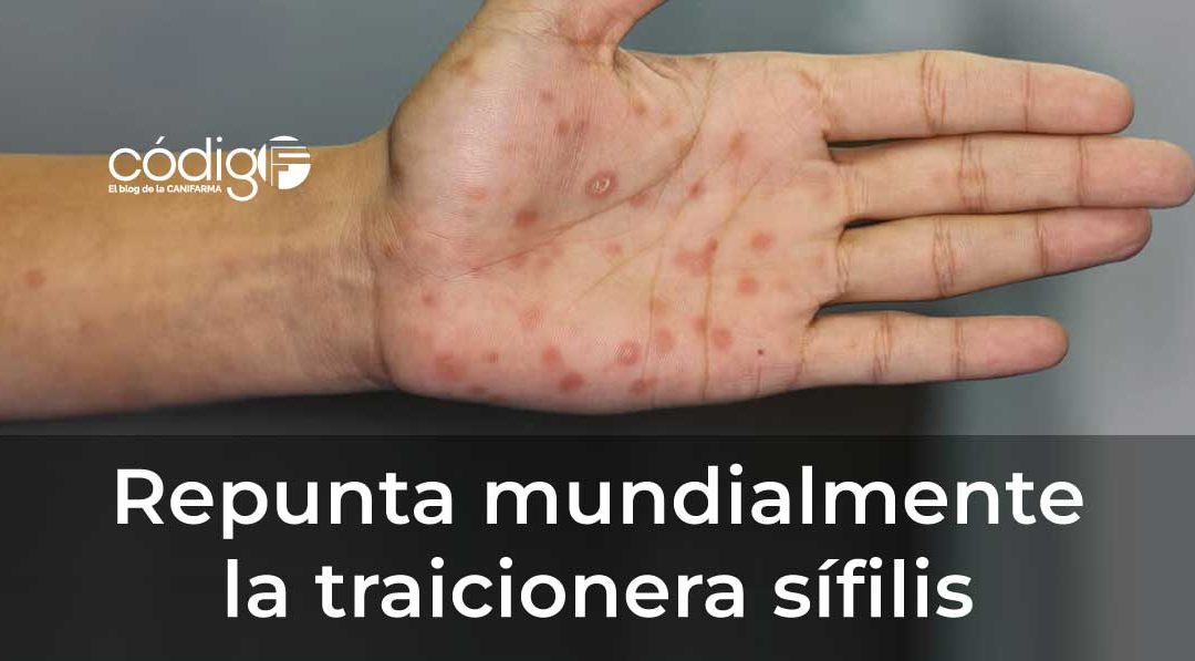Repunta mundialmente la traicionera sífilis