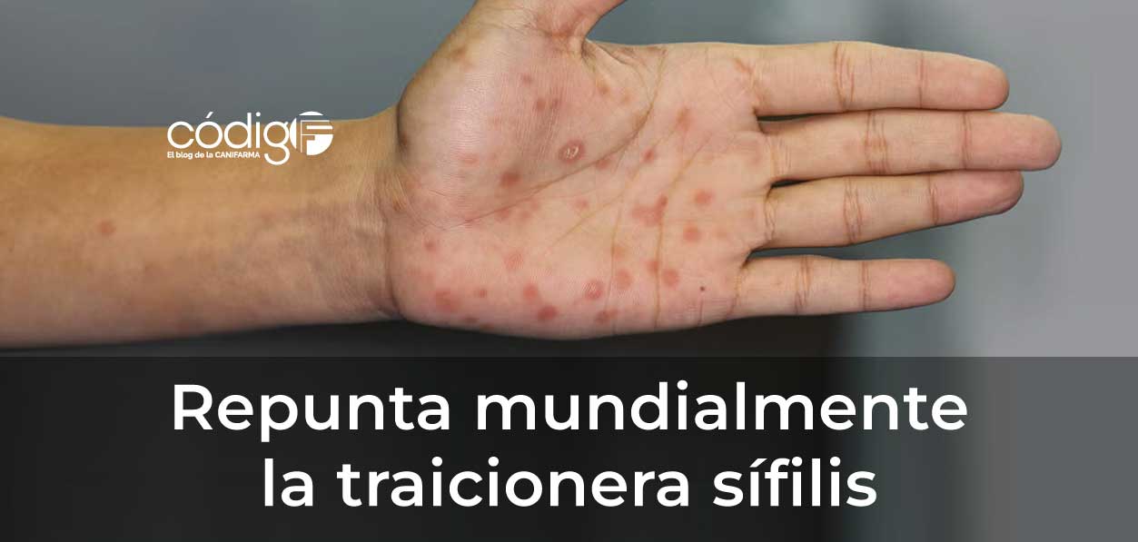Repunta mundialmente la traicionera sífilis