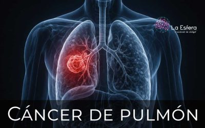 Cáncer de pulmón | 6 de abril de 2026 | Escúchelo ahora