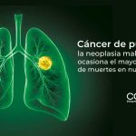 Cáncer de pulmón, la neoplasia maligna que ocasiona el mayor número de muertes en nuestro país