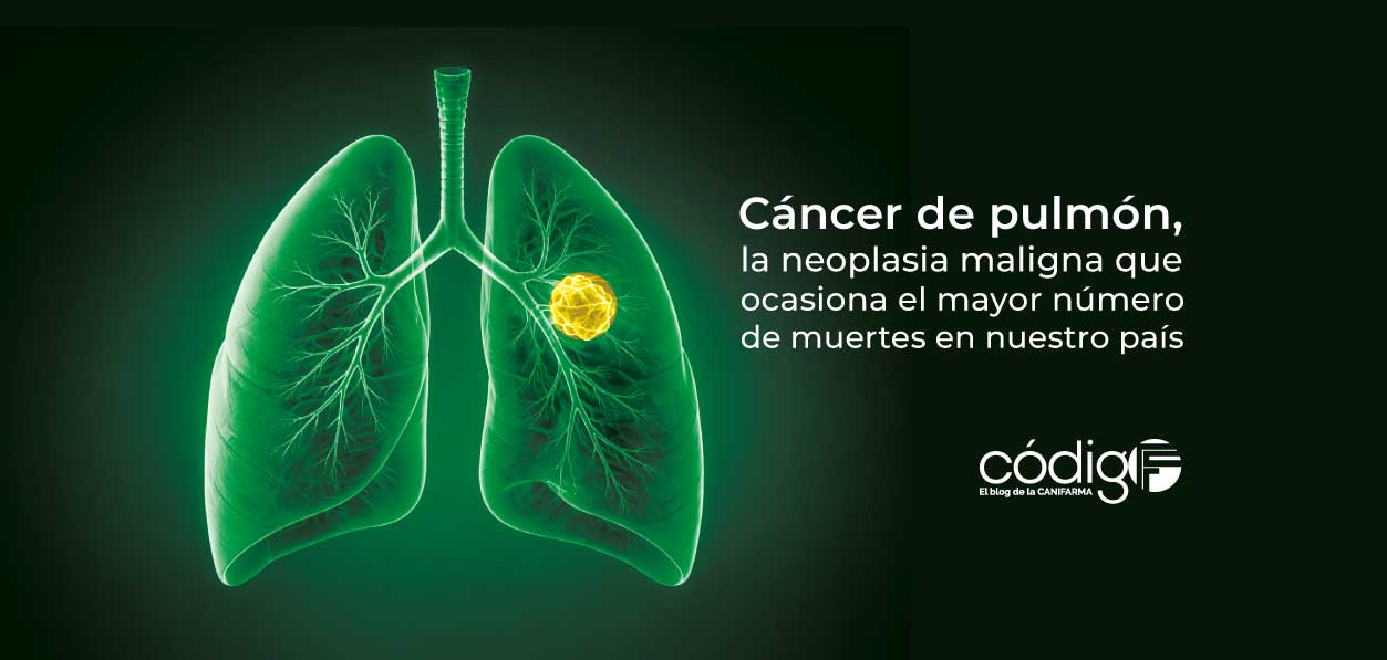 Cáncer de pulmón, la neoplasia maligna que ocasiona el mayor número de muertes en nuestro país
