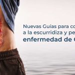 Nuevas Guías para combatir a la escurridiza y peligrosa enfermedad de Crohn