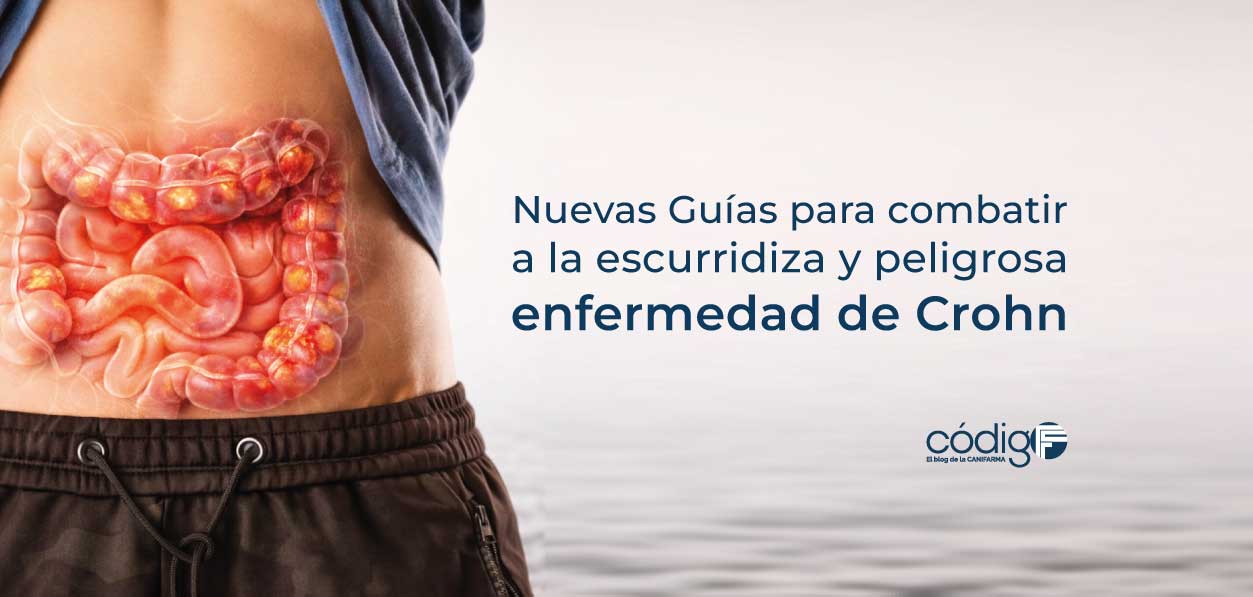 Nuevas Guías para combatir a la escurridiza y peligrosa enfermedad de Crohn