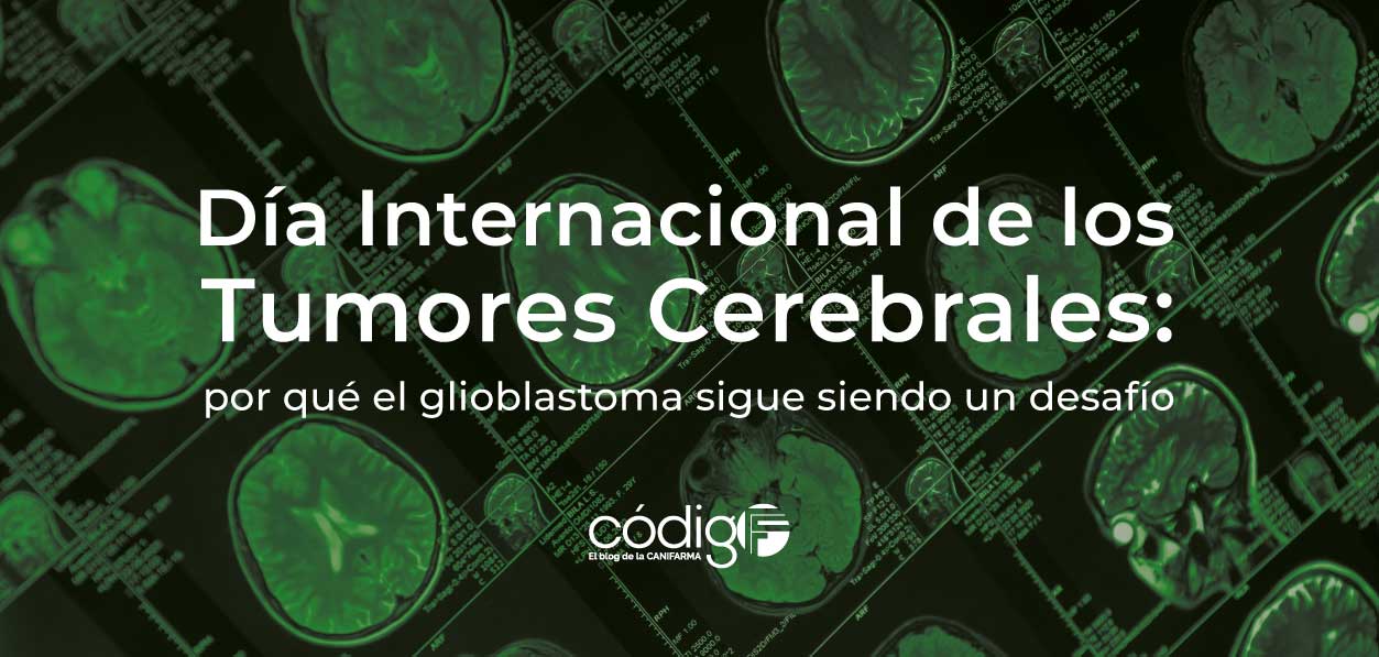 Día Internacional de los Tumores Cerebrales: por qué el glioblastoma sigue siendo un desafío