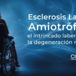 Esclerosis Lateral Amiotrófica: el intrincado laberinto de la degeneración motora