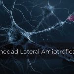Enfermedad Lateral Amiotrófica (ELA) | 22 de junio de 2026 | Escúchelo ahora