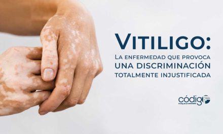 Vitiligo: La enfermedad que provoca una discriminación totalmente injustificada