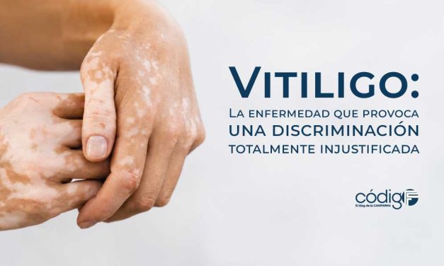 Vitiligo: La enfermedad que provoca una discriminación totalmente injustificada