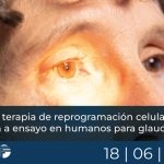 Primera terapia de reprogramación celular parcial llega a ensayo en humanos para glaucoma