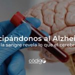 Anticipándonos al Alzheimer: cuando la sangre revela lo que el cerebro oculta