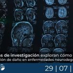 Dos rutas de investigación exploran cómo frenar la acumulación de daño en enfermedades neurodegenerativas
