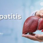 Hepatitis | 27 de julio de 2026 | Escúchelo ahora