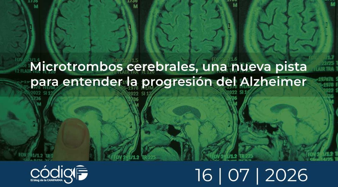 Microtrombos cerebrales, una nueva pista para entender la progresión del Alzheimer