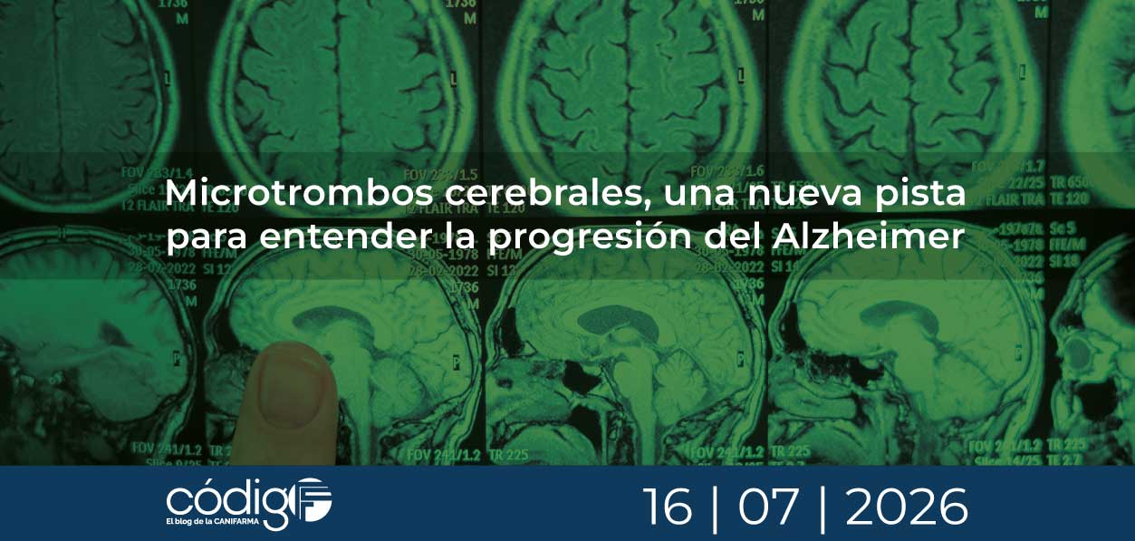 Microtrombos cerebrales, una nueva pista para entender la progresión del Alzheimer