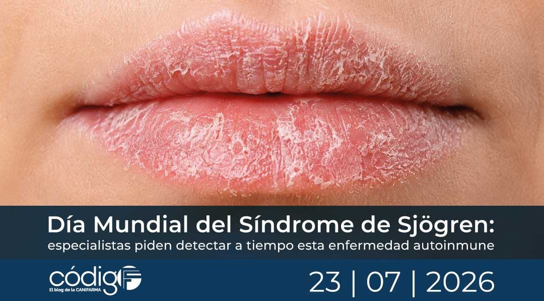 SindromedeSjogren