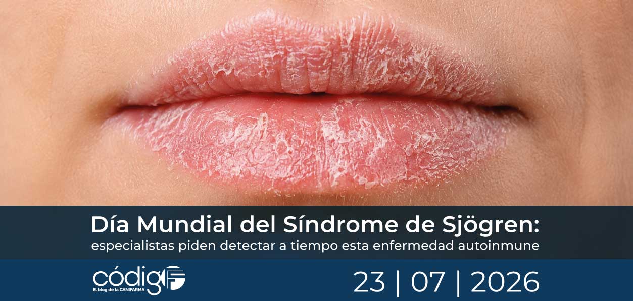 Día Mundial del Síndrome de Sjögren: especialistas piden detectar a tiempo esta enfermedad autoinmune
