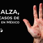 Al alza, los casos de sífilis en México