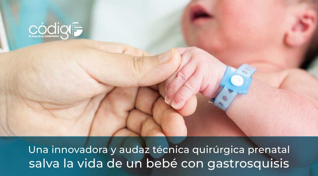 Gastrosquisis