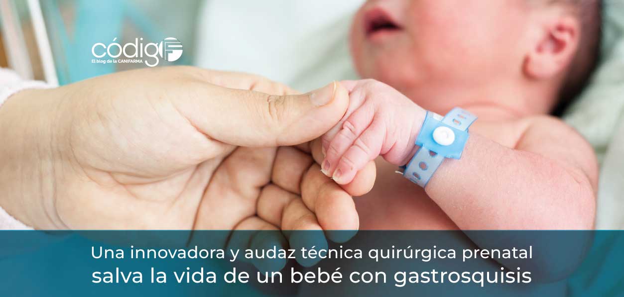 Una innovadora y audaz técnica quirúrgica prenatal salva la vida de un bebé con gastrosquisis