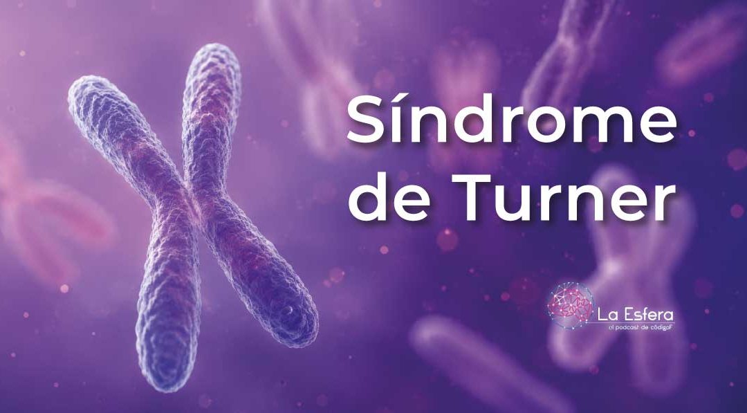 SindromedeTurner