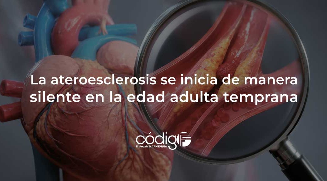 AteroesclerosisSilente
