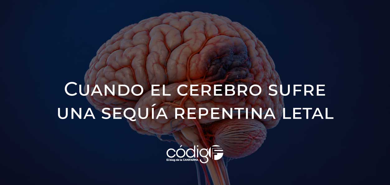 Cuando el cerebro sufre una sequía repentina letal
